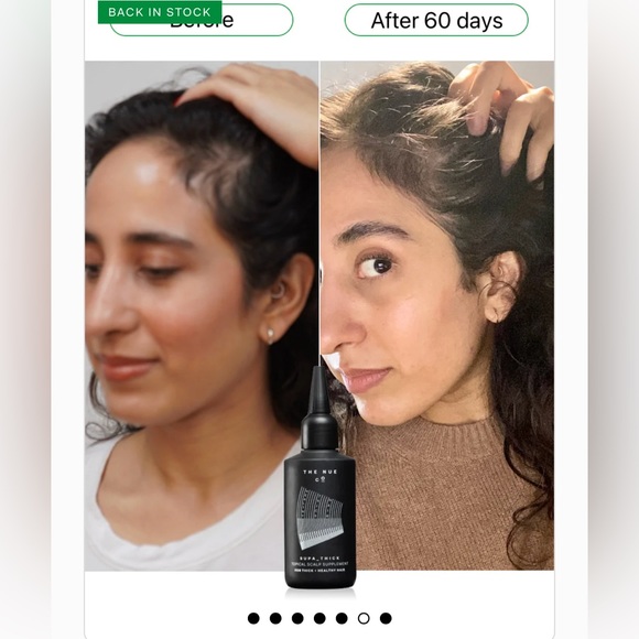 The Nue Co | Supa Thick Topical Scalp Serum/Treatment, NEW - Picture 5 of 6